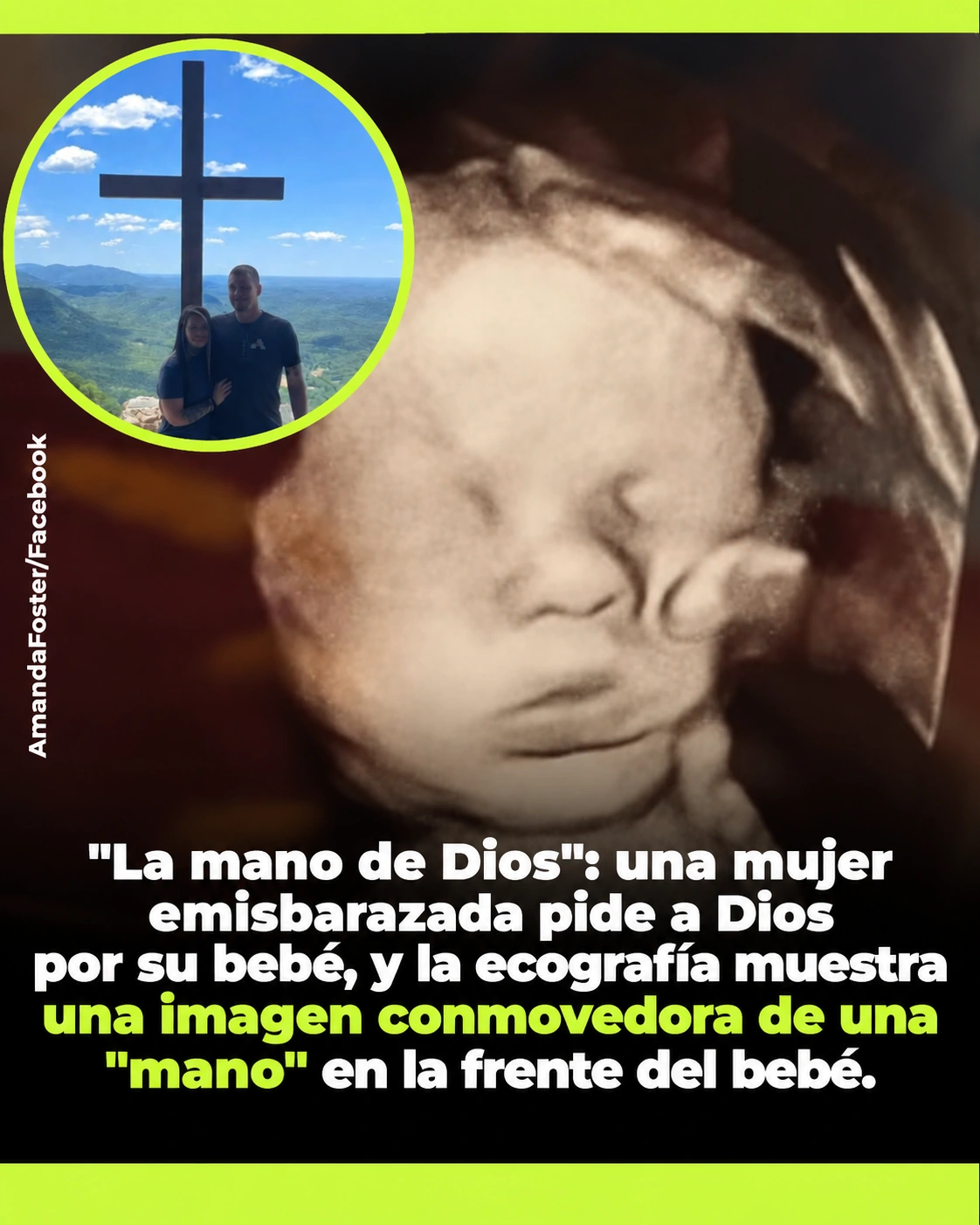 Ecografía de Kyler y la historia de Amanda Foster